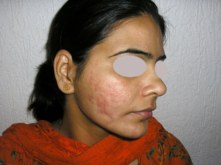 Dr Pandya Clinic Udaipur