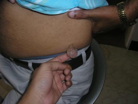 Dr Pandya Clinic Udaipur